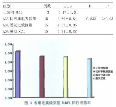 脫發(fā)研究最新進(jìn)展揭示，未來治療的新方向探索