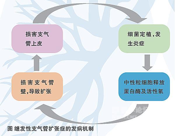 支氣管擴張最新治療方案，探索進展與前沿技術