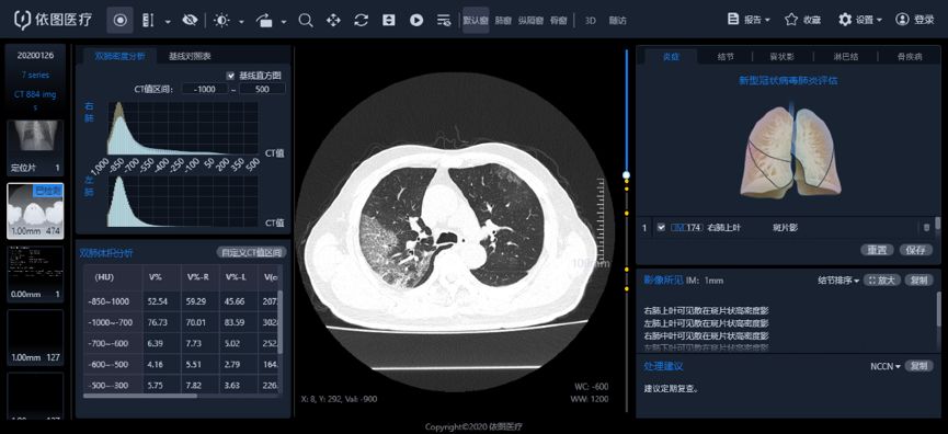 全球冠型肺炎最新信息，疫情现状与应对策略综述